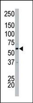 PCTAIRE2 (PCTK2) Antibody (N-term)