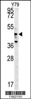 NLK-T286 Antibody (Center)