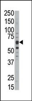 DYRK1B Antibody (C-term)