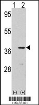 CDK3 Antibody (N-term Y19)