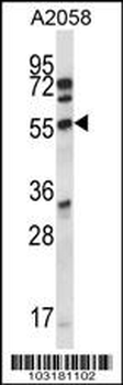 ALS2CR7 Antibody (N-term)