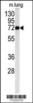 MAOB Antibody (Center)