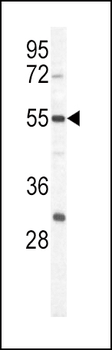 PKM1 Antibody (C-term L398)