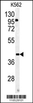 OMD Antibody (Center)