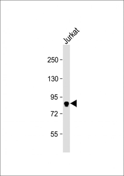 MLH1 Antibody (C-term)
