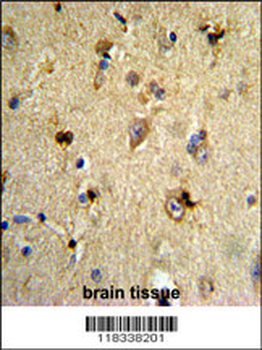 EN2 Antibody (C-term)