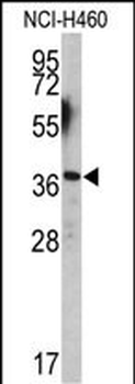 EN2 Antibody (C-term-2)