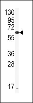 CYP2J2 Antibody (Center)