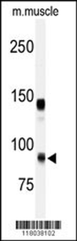 ADAMTS5 Antibody (Center)