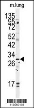 GOLPH3 Antibody (C-term)
