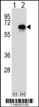 CETP Antibody (N-term)