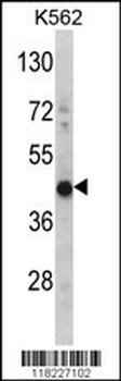 HIBCH Antibody (Center)