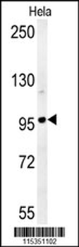 GIT1 (Y554) Antibody (C-term)
