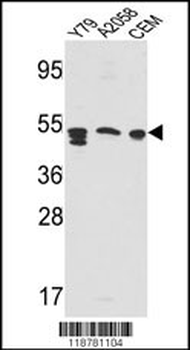 SAP Antibody (Center E300)