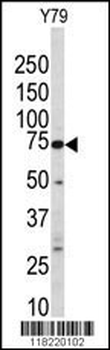 GGTLA1 Antibody (N-term)
