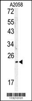 MOBKL1B Antibody (C-term)