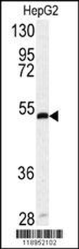 SERPINH1 Antibody (Center)