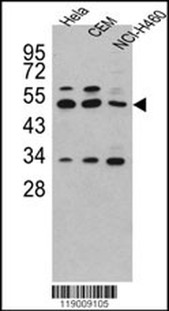 CPA4 Antibody (C-term)
