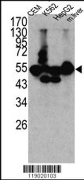CPN1 Antibody (N-term)