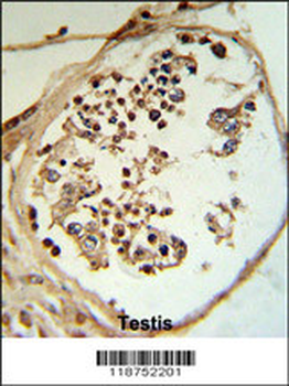 LYAR Antibody (N-term)