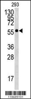 Western blot analysis of BTBD1 antibody (Center) in 293 cell line lysates (35 ug/lane). BTBD1 (arrow) was detected using the purified Pab.