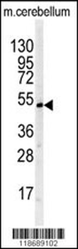 Western blot analysis of BTBD1 antibody (Center) in mouse cerebellum tissue lysates (35 ug/lane). BTBD1 (arrow) was detected using the purified Pab.