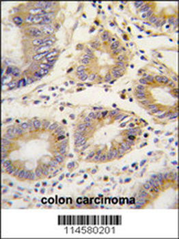 Lefty (LEFTB) Antibody (C-term)