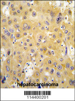 ECGF1 Antibody (Center)