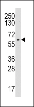 Aromatase (CYP19A1) Antibody (Center)