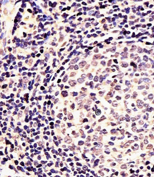 EN1 (Engrailed 1) Antibody (N-term)