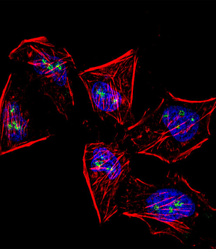 MOX1 (Meox1) Antibody (N-term)