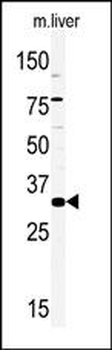 HMX2 Antibody (C-term)