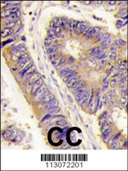 PIST Antibody (Center)