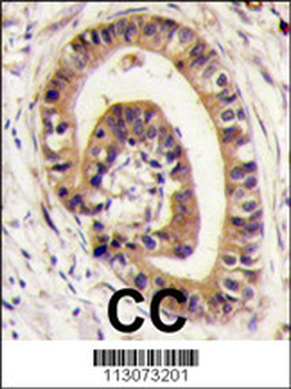 PIST Antibody (C-term)