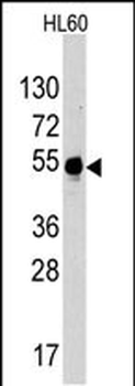 MYT1 Antibody (C-term)