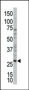 TSSK3 Antibody (N-term)