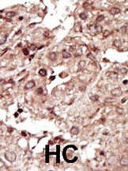 PHKG1 Antibody (Center)