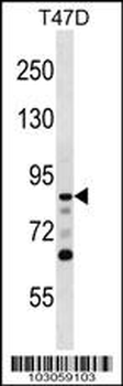 DCAMKL1 Antibody (N-term)
