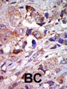 ZPK Antibody (C-term)