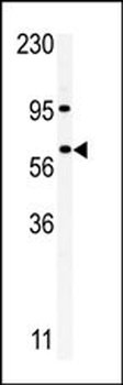RIOK1 Antibody (C-term)