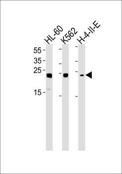 HMGB2 Antibody (Center)