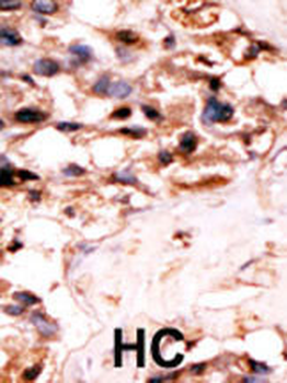 URKL1 Antibody (N-term)