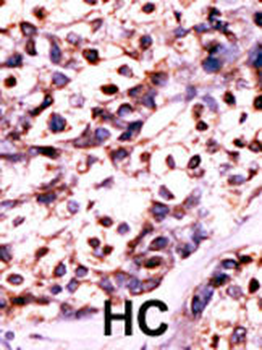 UCK2 Antibody (N-term)