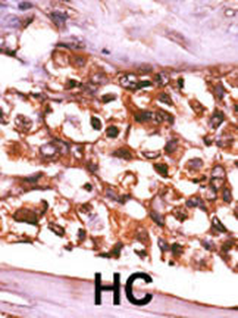 RBKS (RBSK) Antibody (N-term)