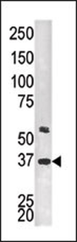 Twinfilin-2 (PTK9L) Antibody (C-term)