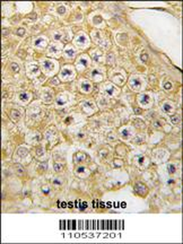 PBK Antibody (C-term C300)