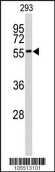 MNK2 (MKNK2) Antibody (C-term)