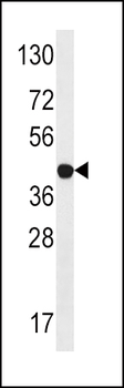 LYK5 Antibody (C-term)
