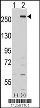 LMTK2 Antibody (Center)
