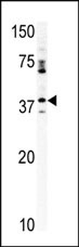 CCRK Antibody (N-term)